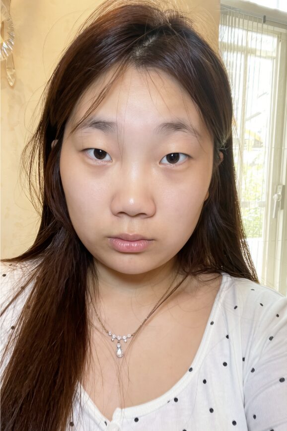 After enhancement