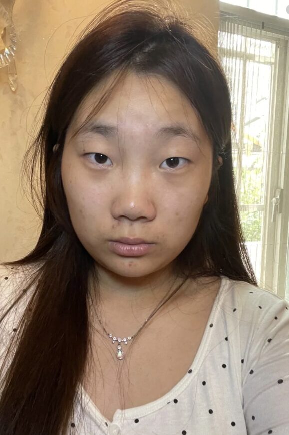 Before enhancement